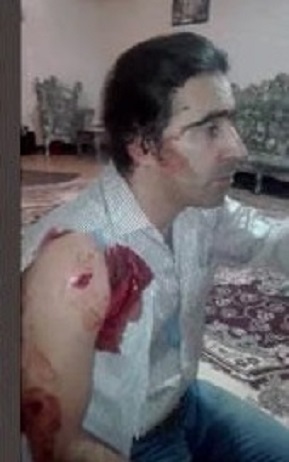 20171122115750188100931